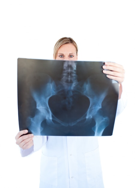 Anspruchsvoller weiblicher Doktor, der einen Röntgenstrahl hält