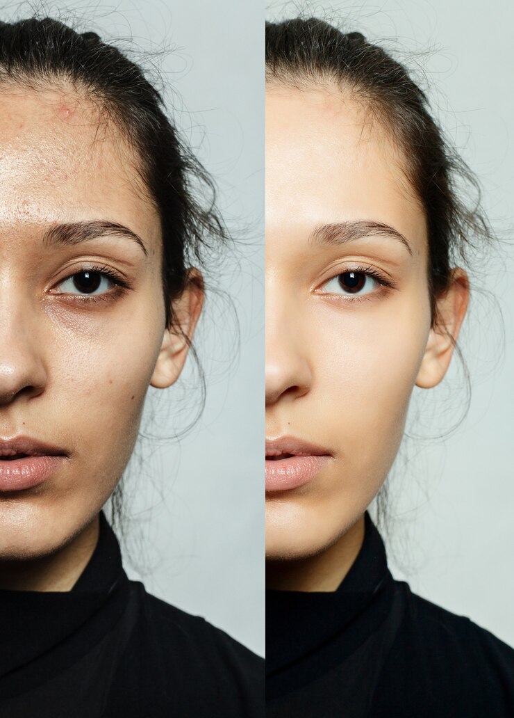 Foto antes e depois do procedimento cosmético ou plástico anti-envelhecimento