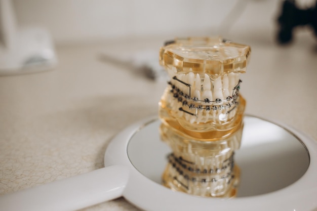 Foto aparelhos metálicos e cerâmicos nos dentes em mandíbulas artificiais closeup aparelhos nos dentes artificiais