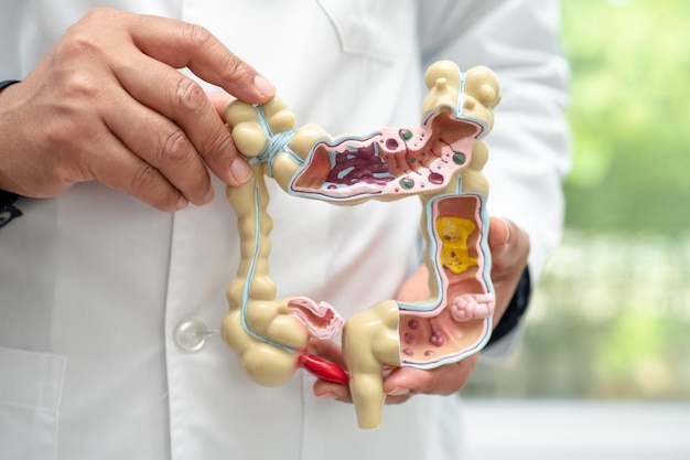 Apéndice intestinal y médico del sistema digestivo con modelo de anatomía para el estudio de diagnóstico y tratamiento en el hospital