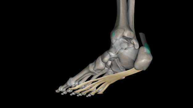 Foto la aponeurosis plantar es la modificación de la fascia profunda que cubre la suela