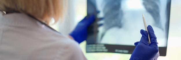 Foto aproximação da médica pneumologista segurando a fotografia de raio-x dos pulmões nas mãos radiologista