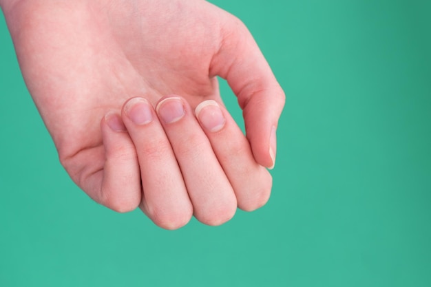 Aproximação de unhas quebradiças Mão feminina caucasiana em um espaço de cópia de fundo verde Idéia de manicure