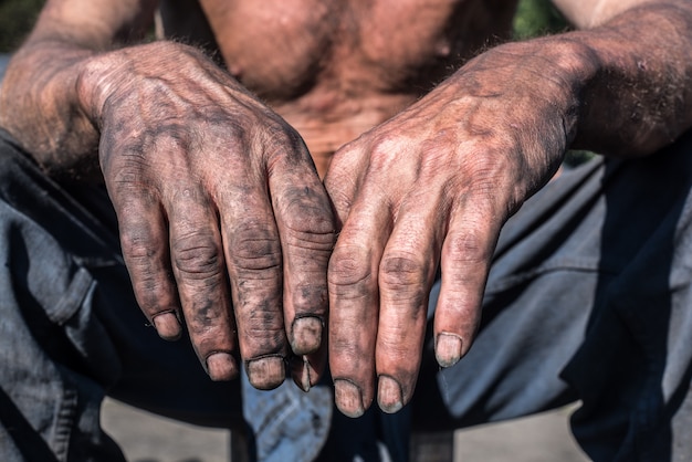 Arbeiterhände. Holzkohlebrenner Arbeiter mit schmutzigen Händen.