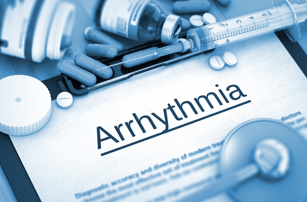 Arrhythmie-Diagnose mit Zusammensetzung der Medikamente