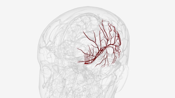 Foto arteria cerebral média esquerda e ramos