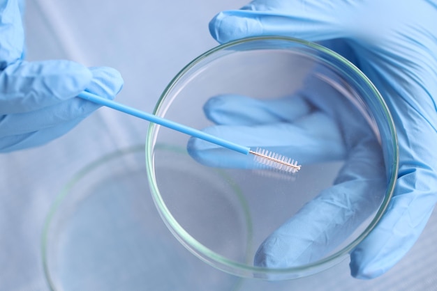 Arzt in blauen Gummihandschuhen hält Zytobürste über Petrischale Nahaufnahme Labordiagnose von