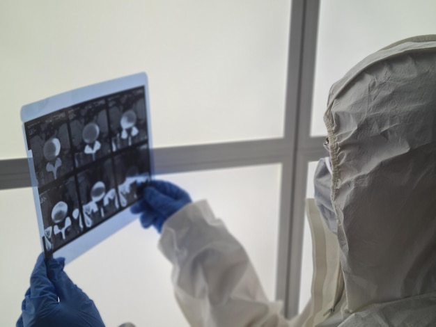 Arzt in Schutzanzug und Maske hält ein Röntgenkonzept in der Hand