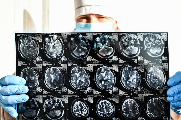 Foto arzt in schutzhandschuhen hält gehirn-mri in der arztpraxis mri-scan des menschlichen kopfes in der klinik