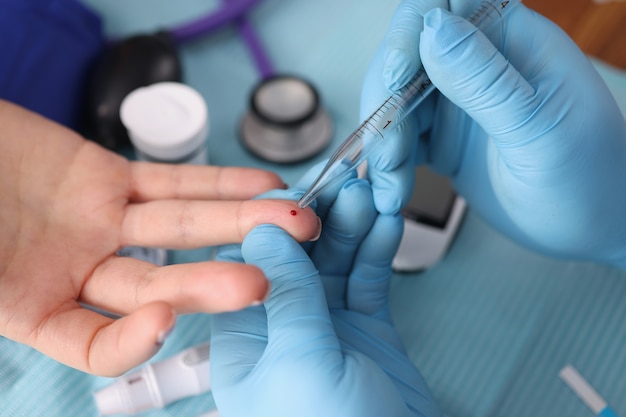 Arzt nimmt Bluttest vom Patientenfinger mit Pipette in Labornahaufnahme. Labordiagnostik interner Erkrankungen Konzept