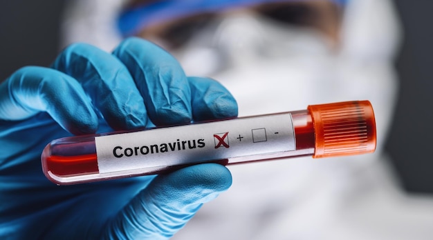 Arzt oder krankenschwester in schutzanzug und gesichtsschutz mit einem positiven bluttestergebnis für coronavirus oder covid19