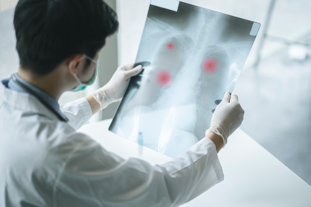 Arzt prüft die Untersuchung des Röntgenfilms des Brustkorbs des Patienten im Stationskrankenhaus. Corona-Virus Covid-19-Konzept.