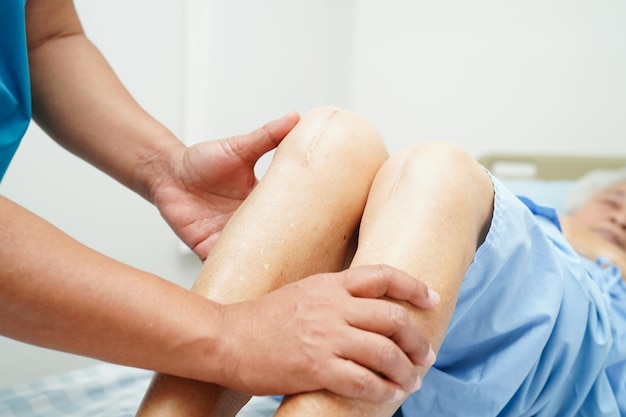 Arzt untersucht asiatische ältere Patientin mit Narben-Knieersatzoperation im Krankenhaus