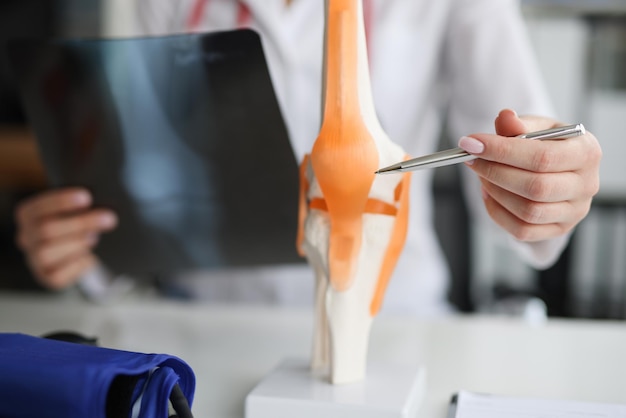 Foto arzttraumatologe untersucht röntgen und beine und das modell des kniegelenks