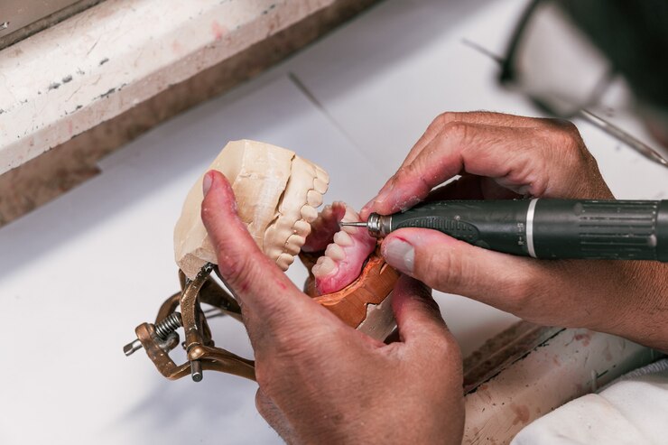 As mãos de um técnico de prótese dentária preenchendo um implante dentário com uma ferramenta elétrica em uma oficina