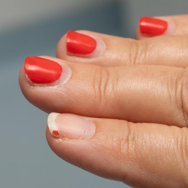 Foto as unhas danificadas com esmalte vermelho nas mãos das mulheres