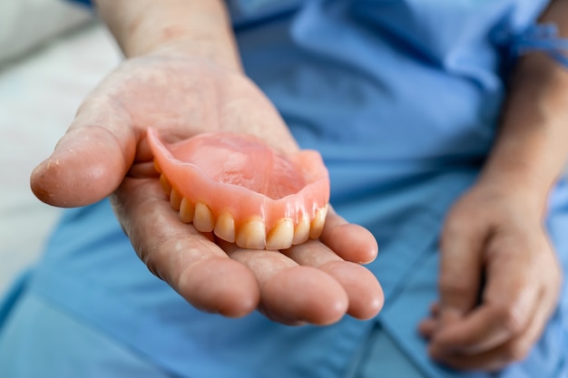 Asiatische ältere Patientin, die Prothese im Krankenhaus hält.