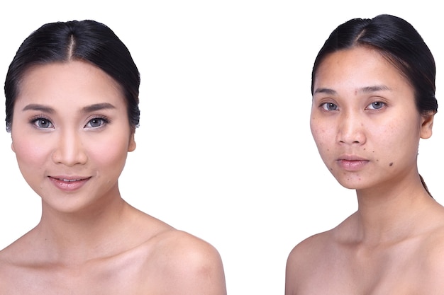 Asiatische Frau vor und nach Make-up. keine Retusche, frisches Gesicht mit Akne, Hautflecken, Warze dann gute Basis- und Foundationkosmetik, isoliert