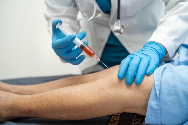 Asiatischer Arzt injiziert Hyaluronsäure-plättchenreiches Plasma in das Knie einer älteren Frau, um schmerzfrei zu gehen