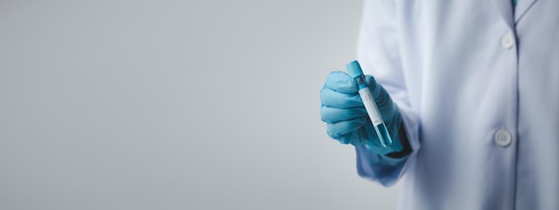 El asistente de laboratorio, un científico médico, un investigador químico, sostiene un tubo de vidrio a través de la muestra de sangre, hace un experimento químico y examina la muestra de sangre de un paciente. Concepto de medicina e investigación.