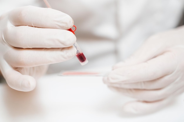 Asistente de laboratorio sostiene primer plano de tubo de ensayo para análisis ginecológico y citológico Científica que trabaja en laboratorio médico