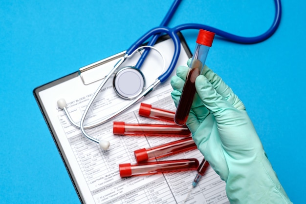 Asistente de técnico de laboratorio o médico con guantes de goma o látex sosteniendo el tubo de análisis de sangre sobre el portapapeles con formulario en blanco.