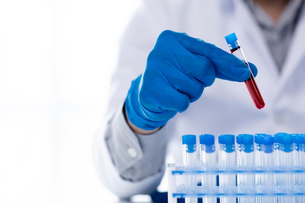 Assistente de laboratório um cientista médico um pesquisador de química segura um tubo de vidro através da amostra de sangue faz um experimento químico e examina a amostra de sangue de um paciente Conceito de medicina e pesquisa