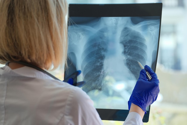 Assistente médico ou radiologista detém ponteiro para exame e treinamento em educação torácica