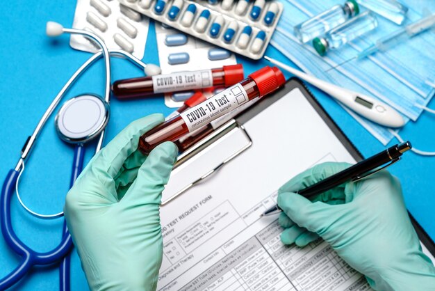 Assistente técnico de laboratório ou médico usando luvas de borracha ou látex segurando um tubo de ensaio de sangue sobre