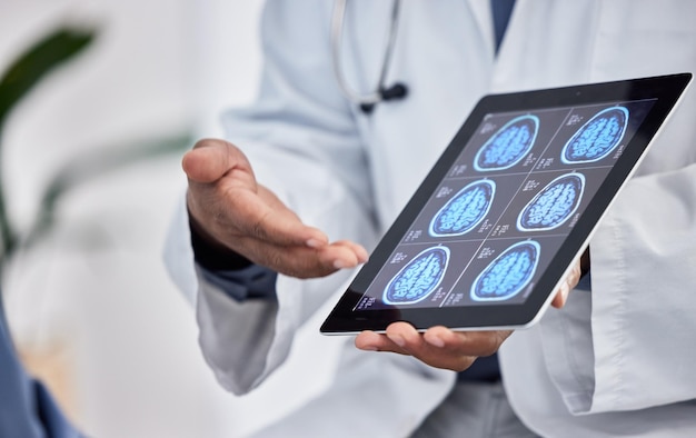 Atención médica de neurología y médico con tableta en las manos para resultados de pruebas de investigación cerebral o innovación de cáncer en consultas hospitalarias o clínicas Trabajador médico en tecnología digital para evaluación de resonancia magnética