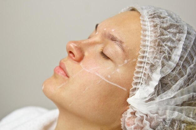 Attraktive Patientin mit Anweisungen auf ihrem Gesicht für die Operation der plastischen Chirurgie Chirurg, der das Gesicht einer Person berührt Das Konzept der ästhetischen Kosmetologie und Injektion
