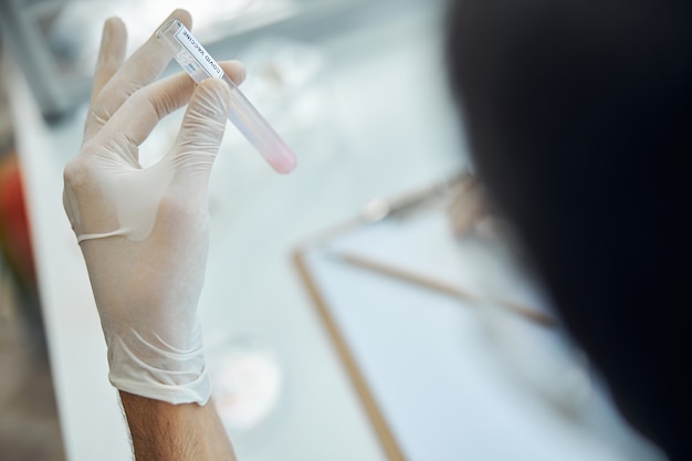 Ausgeschnittenes Foto eines Arztes für Infektionskrankheiten, der ein Reagenzglas mit einem Covid-Impfstoff hält