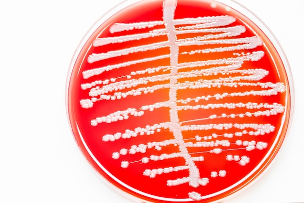 Las bacterias cuentan en el cultivo de orina