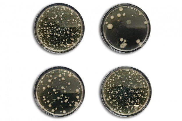 Bacterias en una placa de agar aislada del aire