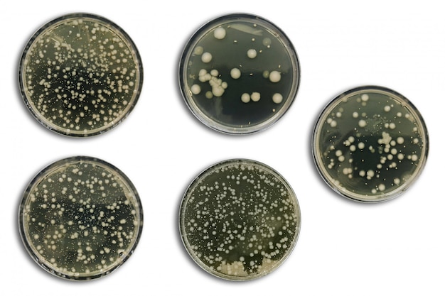 Bacterias en una placa de agar aislada del aire