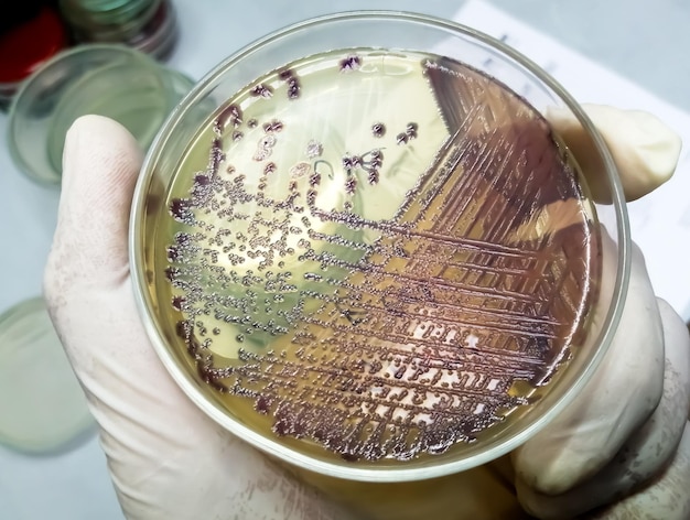 Foto bakterienkolonie von escherichia coli oder ecoli in kulturmedienplatte