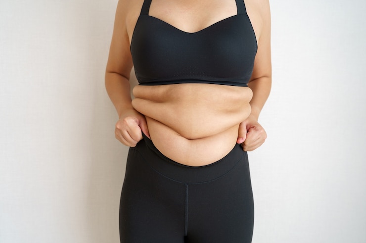 Foto barriga de gordura corporal de mulheres. mão de mulher obesa segurando a gordura excessiva da barriga.