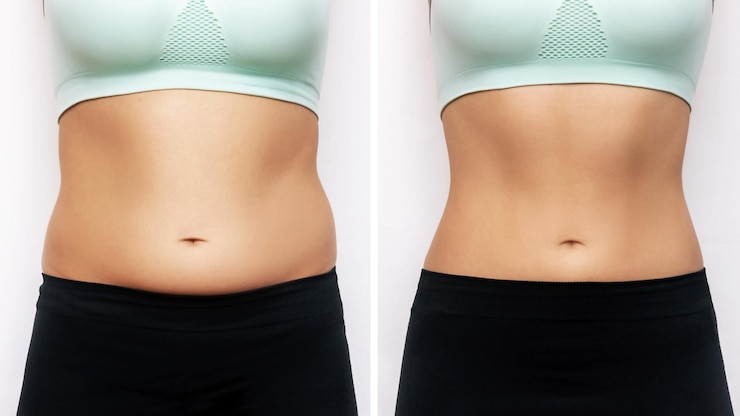 Foto barriga de uma mulher com excesso de gordura e estômago magro tonificado com abs antes e depois de perder peso
