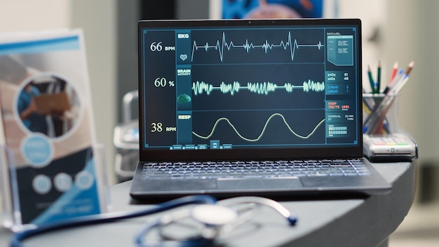 Batimento cardíaco no laptop na recepção vazia, executando o cardiograma para análise da frequência cardíaca. Contador vazio do centro de diagnóstico com pc mostrando pressão de pulso para diagnóstico. Tiro portátil. Fechar-se.