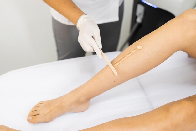Beautician aplica un gel especial para la depilación láser en la pierna de una mujer