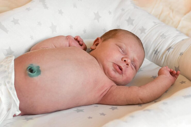 Foto bebê recém-nascido com umbigo não curado tratamento do cordão umbilical tratamento antiséptico bebê deitado