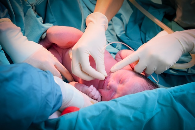 Foto bebê recém-nascido no teatro cirúrgico nascido do útero.