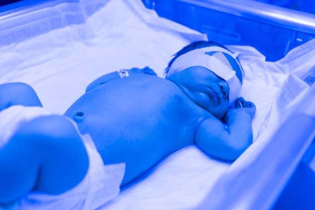 Foto un bebé recién nacido yace bajo lámparas ultravioleta bajo luz azul tratamiento con bilirrubina alta de ictericia infantil incubadora ultravioleta