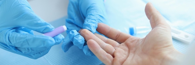 Foto behandschuhter arzt nimmt bluttest mit lanzette vom patienten in der klinik zur lieferung des analysekonzepts vor