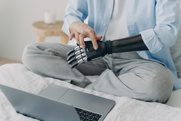 Behinderte Frau mit künstlichem Arm, die zu Hause am Laptop arbeitet Bionische Prothese einrichten