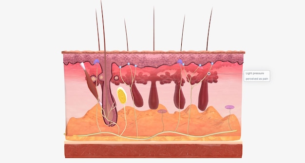 Foto bei fibromyalgie werden die nerven gegenüber äußeren reizen überempfindlich, eine veränderung, die als zentrale sensibilisierung bezeichnet wird