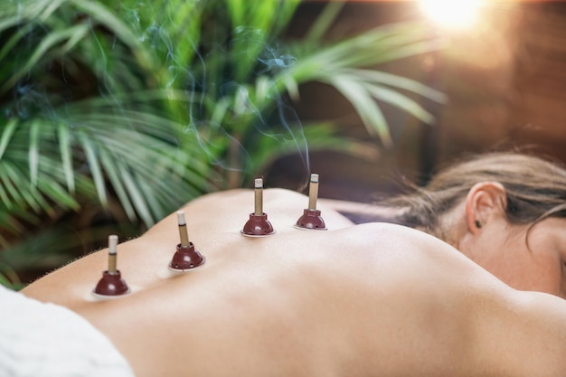 Beifuß-Moxibustion Rückentherapie