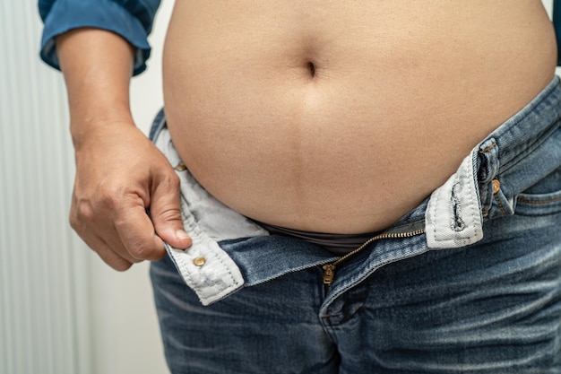 Übergewichtige asiatische Frau zeigen fetten Bauch im Büro