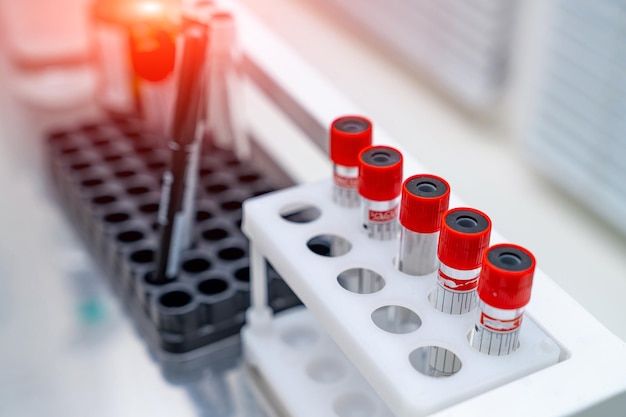 Biochemie-Analysestation Krankenhauslabor zur Analyse von Blutproben