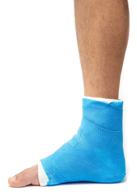 Blauer Knöchel der Schiene. Verbundenes Bein warf auf männlichen Patienten auf weißer Wand lokalisiert. Sportverletzungskonzept.
